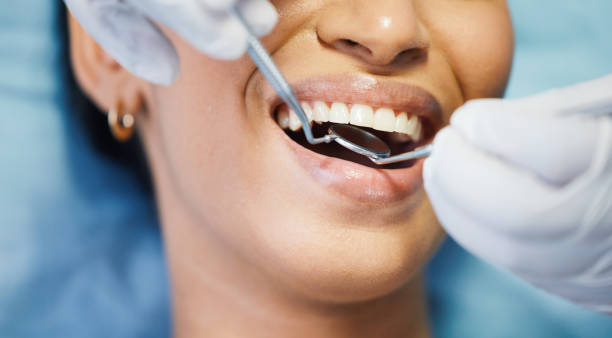 Best Emergency Dental Care for Broken or Chipped Teeth in Noroton, CT